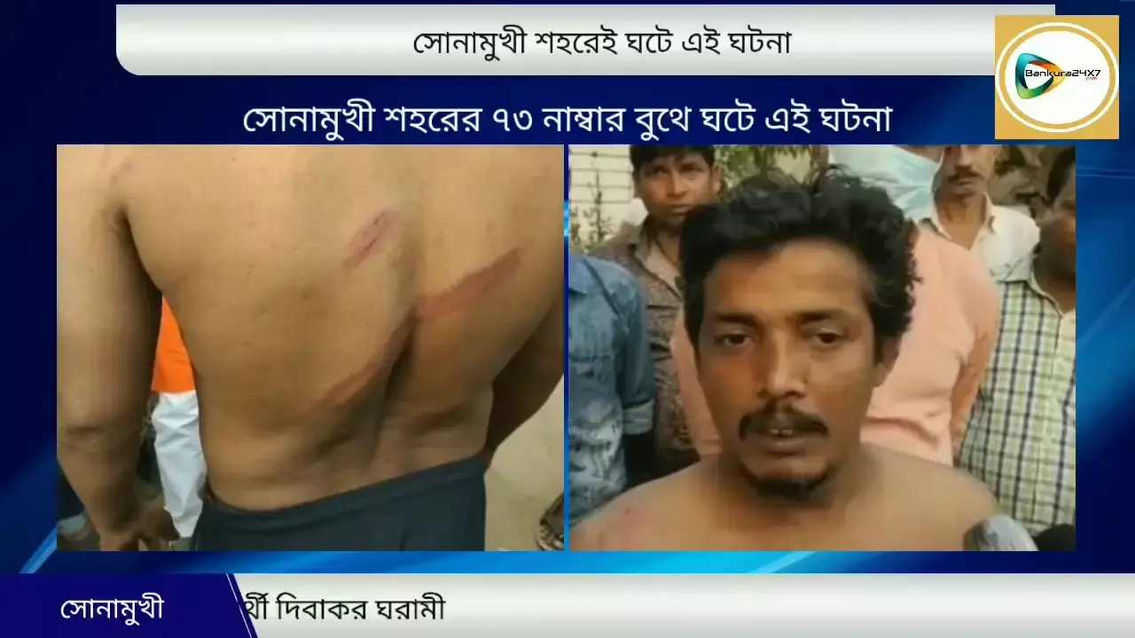 সোনামুখী পৌর শহরেই বেধড়ক মার বিজেপির পোলিং এজেন্টকে, অভিযুক্ত তৃণমূল,এলাকায় উত্তেজনা। সোনামুখী পৌর শহরেই বেধড়ক মার বিজেপির পোলিং এজেন্টকে, অভিযুক্ত তৃণমূল,এলাকায় উত্তেজনা।