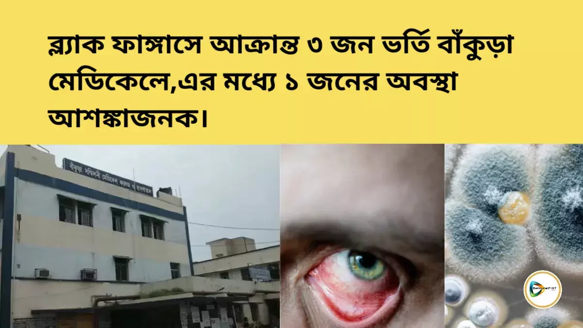 ব্ল্যাক ফাঙ্গাসে আক্রান্ত ৩ জন ভর্তি বাঁকুড়া মেডিকেলে,এর মধ্যে একজনের অবস্থা আশঙ্কাজনক। ব্ল্যাক ফাঙ্গাসে আক্রান্ত ৩ জন ভর্তি বাঁকুড়া মেডিকেলে,এর মধ্যে একজনের অবস্থা আশঙ্কাজনক।