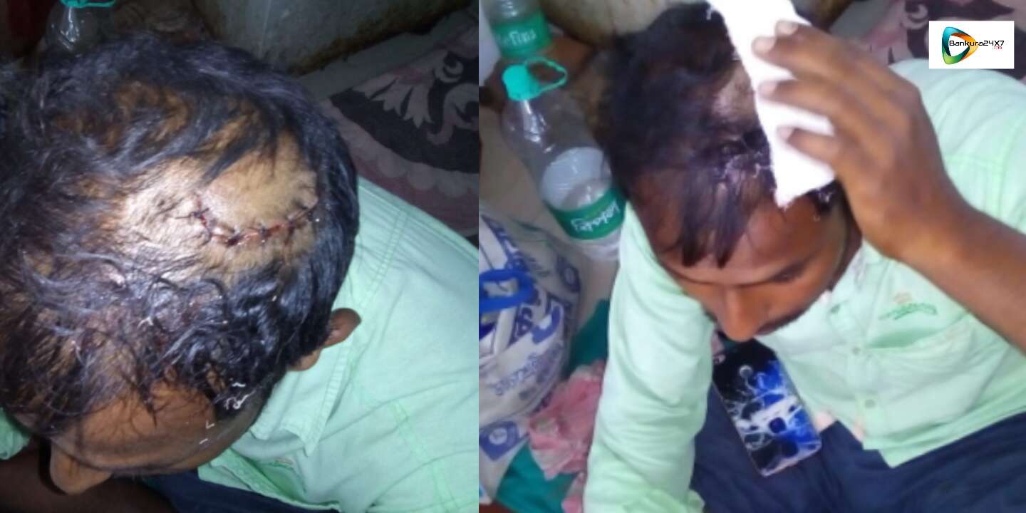 সিমলাপালে ঘুমন্ত অবস্থায় তৃণমূল কর্মীর মাথায় অস্ত্রের কোপ, অভিযোগের আঙ্গুল বিজেপির দিকে, অভিযোগ অস্বীকার বিজেপির সিমলাপালে ঘুমন্ত অবস্থায় তৃণমূল কর্মীর মাথায় অস্ত্রের কোপ, অভিযোগের আঙ্গুল বিজেপির দিকে, অভিযোগ অস্বীকার বিজেপির