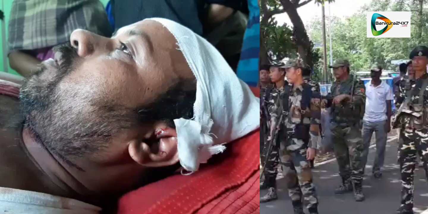 শালতোড়ায় ভোট গননার পর রাজনৈতিক সংঘর্ষ,গুলি, বোমাবাজির অভিযোগ ঘিরে উত্তাল এলাকা। শালতোড়ায় ভোট গননার পর রাজনৈতিক সংঘর্ষ,গুলি, বোমাবাজির অভিযোগ ঘিরে উত্তাল এলাকা।
