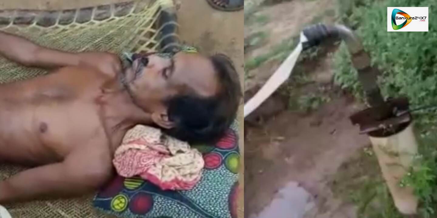 খিচকা গ্রামে সেচের স্যালোতে বিদ্যুৎ পৃষ্ঠ হয়ে আহত এক গ্রামবাসী, বিদ্যুৎদপ্তরের বিরুদ্ধে উঠছে গাফিলতির অভিযোগ! খিচকা গ্রামে সেচের স্যালোতে বিদ্যুৎ পৃষ্ঠ হয়ে আহত এক গ্রামবাসী, বিদ্যুৎদপ্তরের বিরুদ্ধে উঠছে গাফিলতির অভিযোগ!