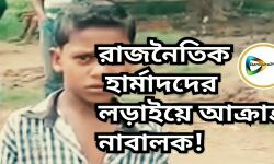 ইন্দাসে রাজনৈতিক হার্মাদদের লড়াইয়ে আক্রান্ত নাবালক, জেলার রাজনীতির লজ্জা! হোক প্রতিবাদ। ইন্দাসে রাজনৈতিক হার্মাদদের লড়াইয়ে আক্রান্ত নাবালক, জেলার রাজনীতির লজ্জা! হোক প্রতিবাদ।