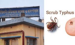 করোনা নয়,বাঁকুড়া মেডিকেলের আইসোলেশন ভর্তি তালডাংরার মহিলা আক্রান্ত  স্ক্রাব টাইফাসে।