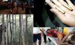 রাবার গুলি নয়,কাঁকরডাঙ্গায় পুলিশের বন্ধুকের গুলিতেই আহত তিন বিজেপি কর্মী, প্রমাণ দিল বিজেপি। রাবার গুলি নয়,কাঁকরডাঙ্গায় পুলিশের বন্ধুকের গুলিতেই আহত তিন বিজেপি কর্মী, প্রমাণ দিল বিজেপি।