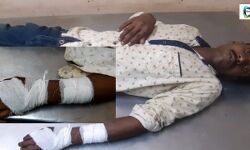 কোতুলপুরে নিমন্ত্রণ খেয়ে ফেরার পথে বিজেপি কর্মীর হাতে অস্ত্রের কোপ, অভিযুক্ত তৃণমূল, অভিযোগ অস্বীকার তৃণমূলের। কোতুলপুরে নিমন্ত্রণ খেয়ে ফেরার পথে বিজেপি কর্মীর হাতে অস্ত্রের কোপ, অভিযুক্ত তৃণমূল, অভিযোগ অস্বীকার তৃণমূলের।